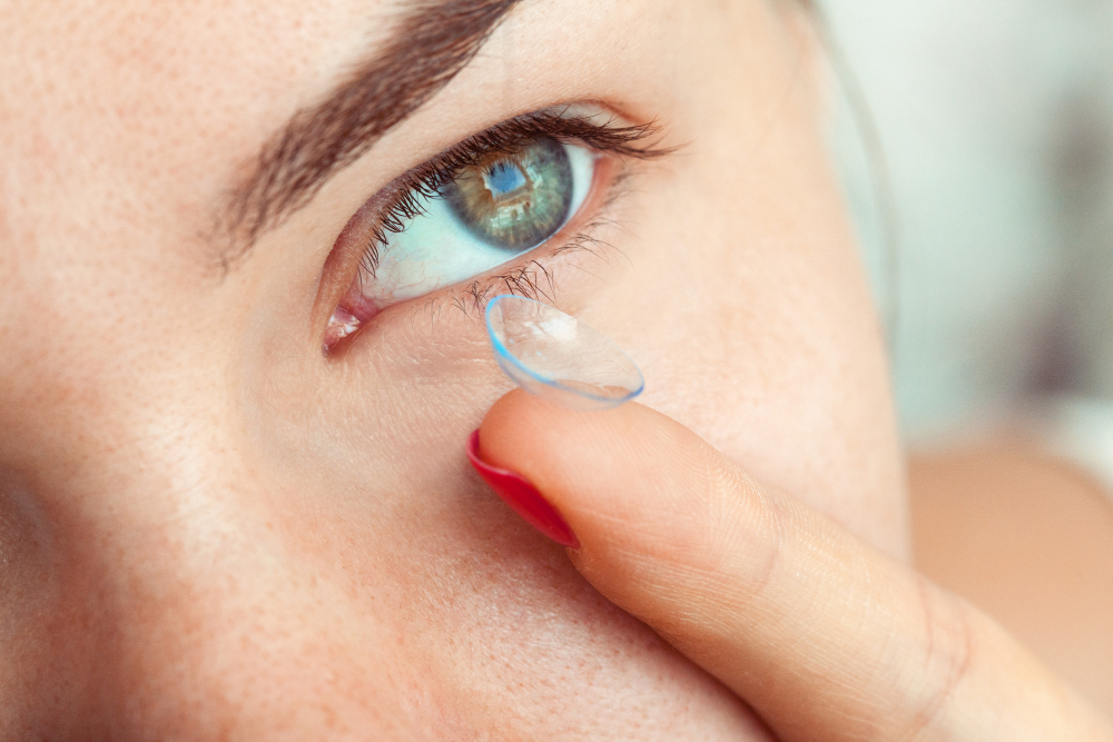 Contact Lenses